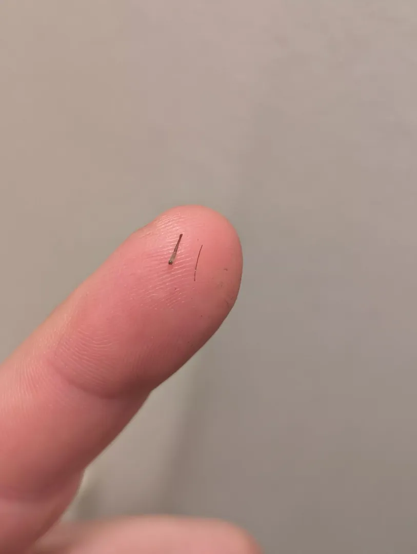 Different whisker thickness from pimple