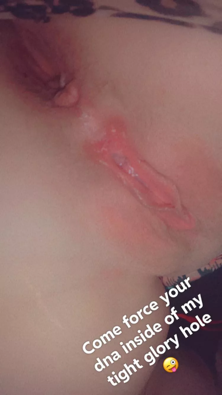 Dms open