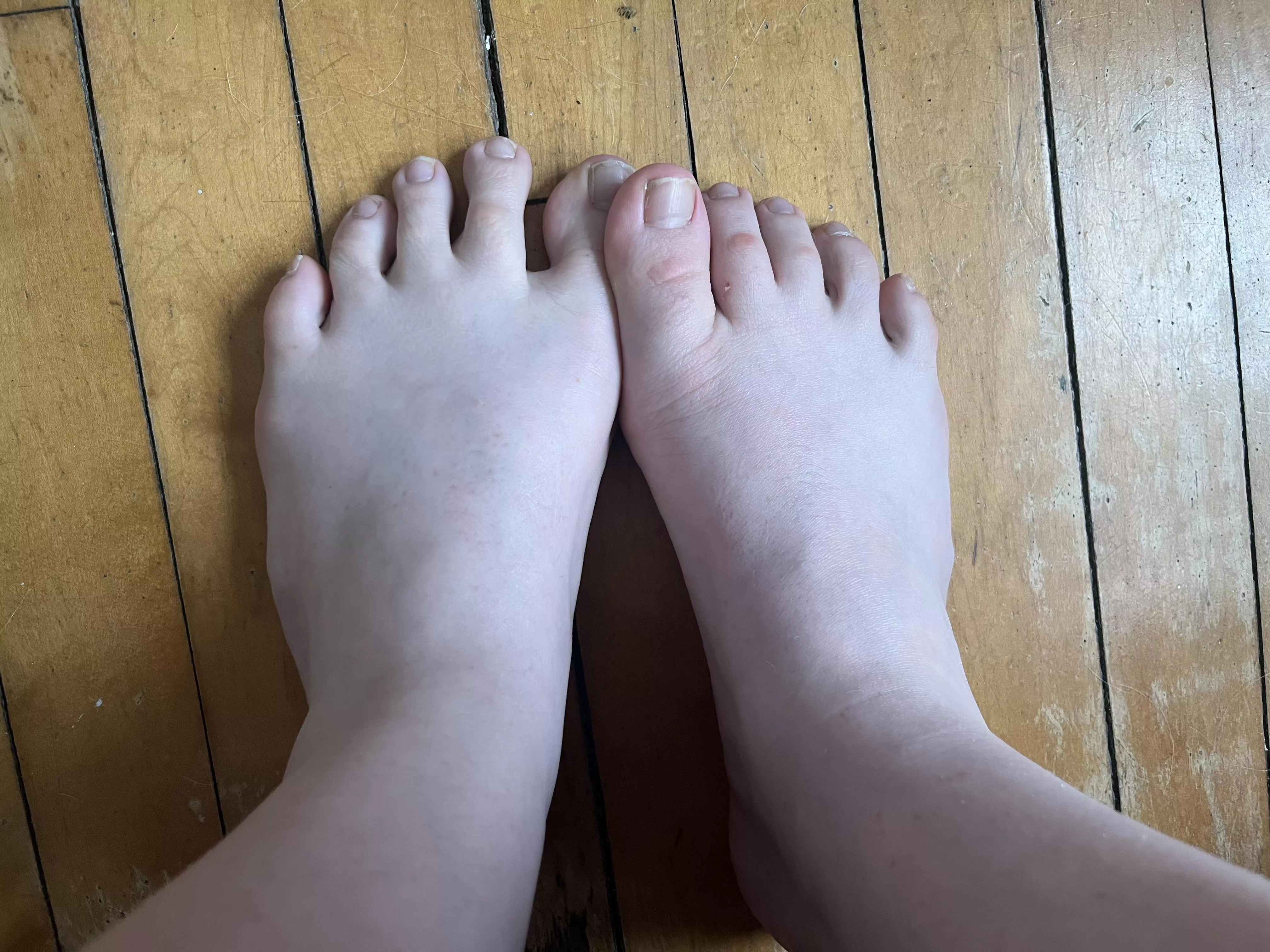 Do big, ugly feet get love too? :( I get so insecure about them…