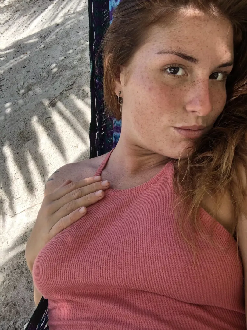 Do I have too many freckles on my face?