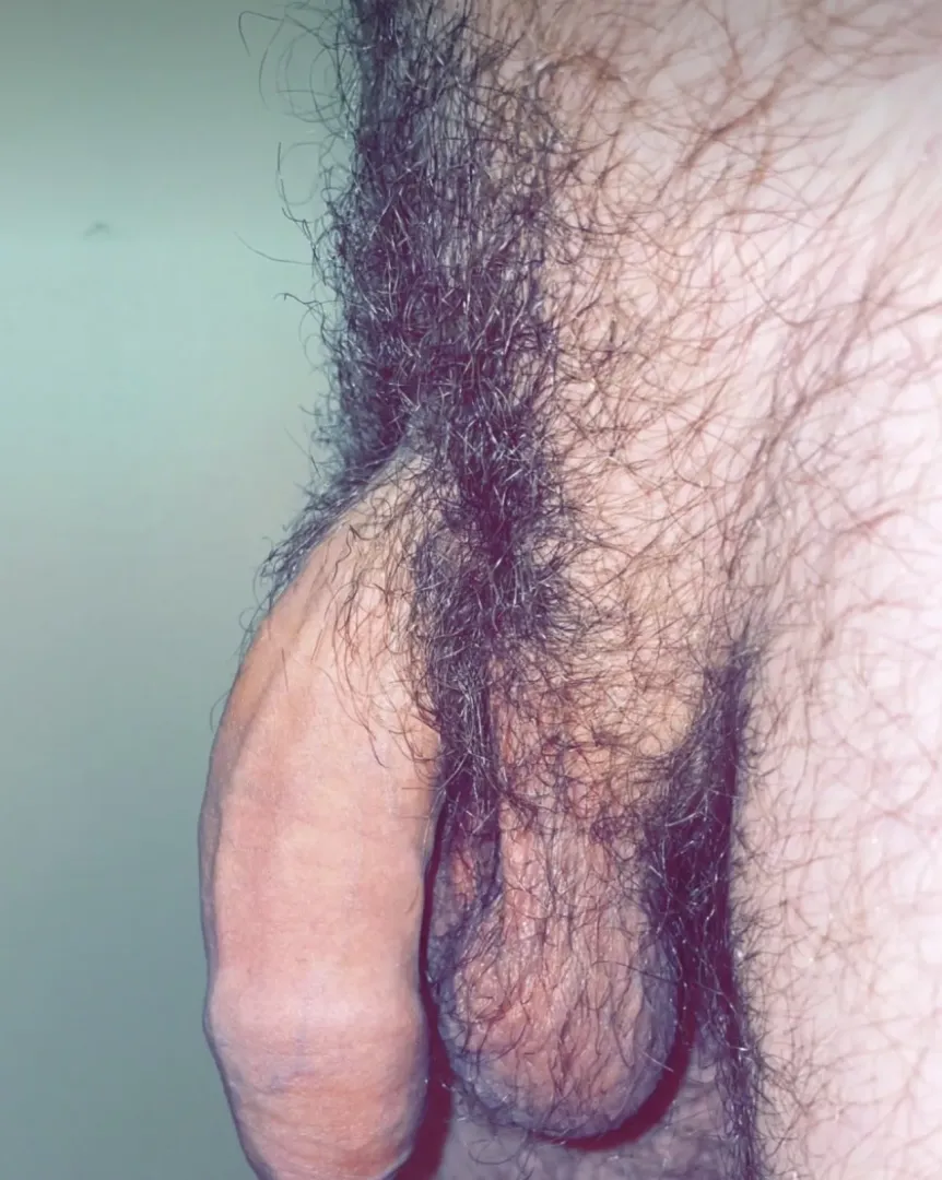 Do I win the pube contest?