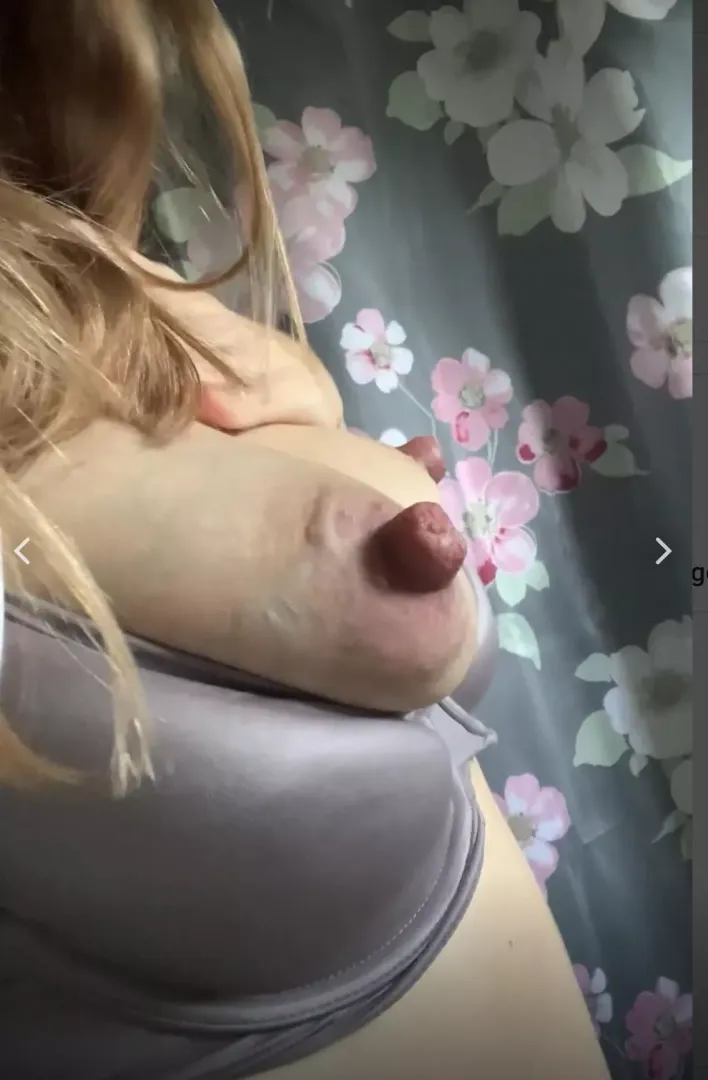 Do my areolas match my nipples?