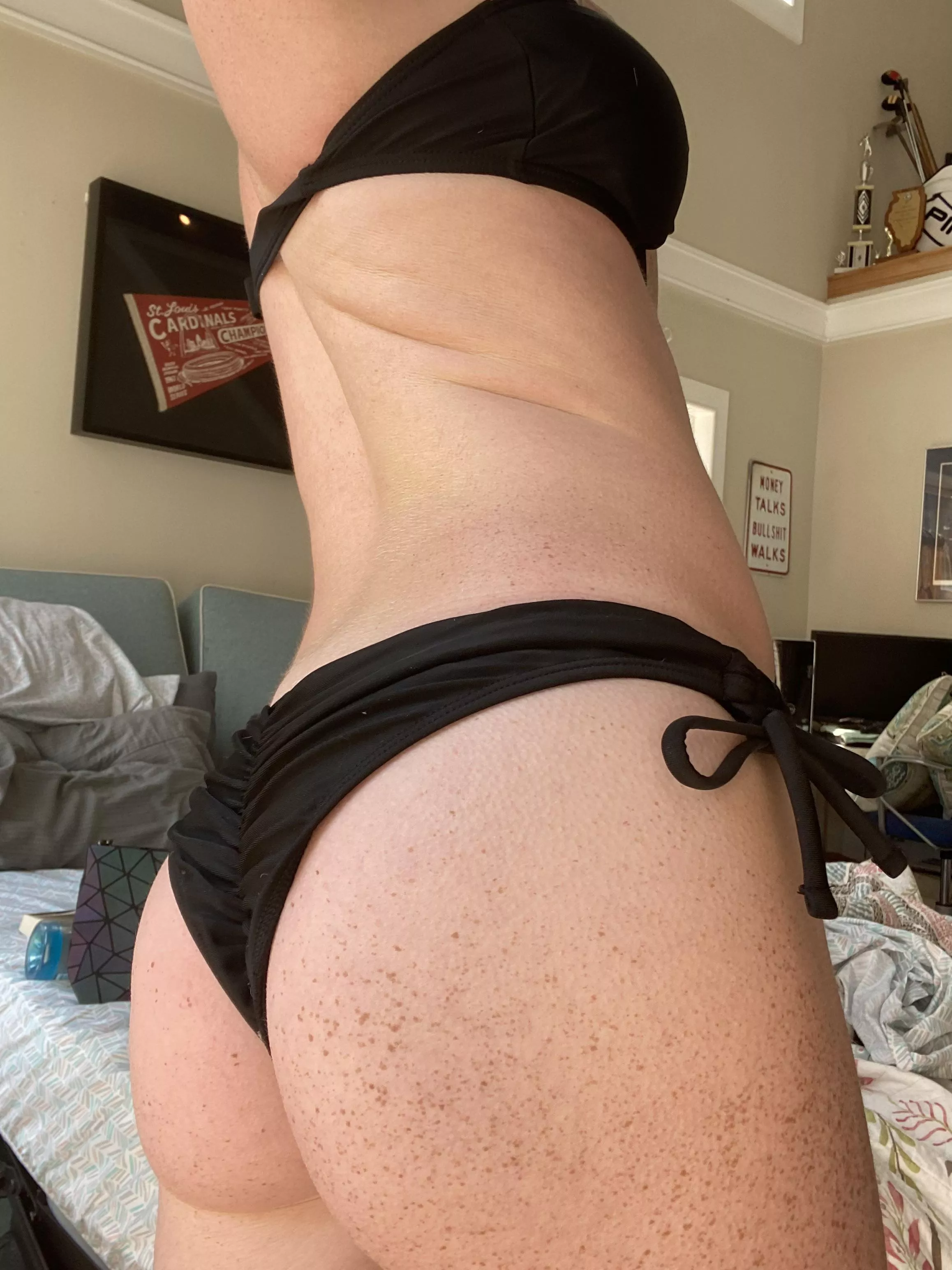 Do you like freckles 