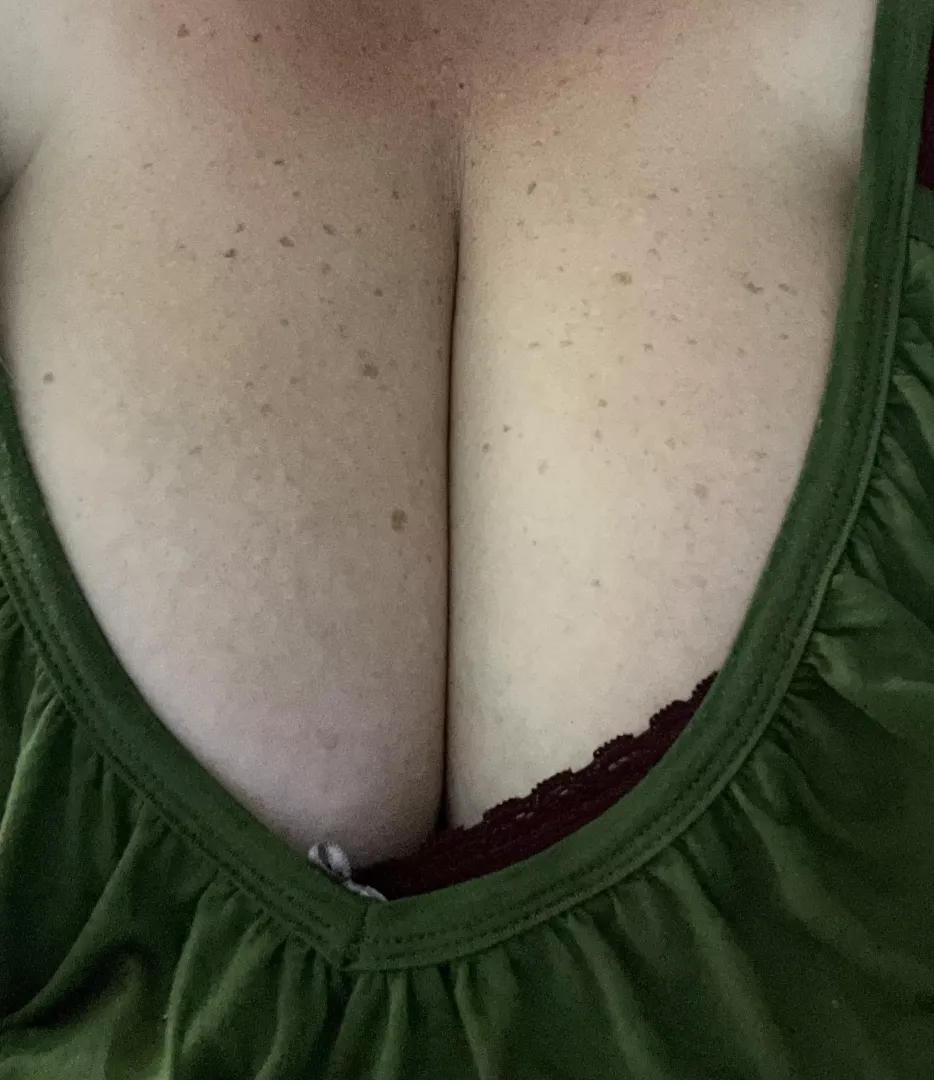 Do you like freckles?