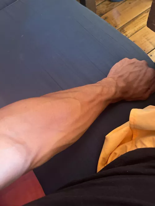 Do you like my arm?