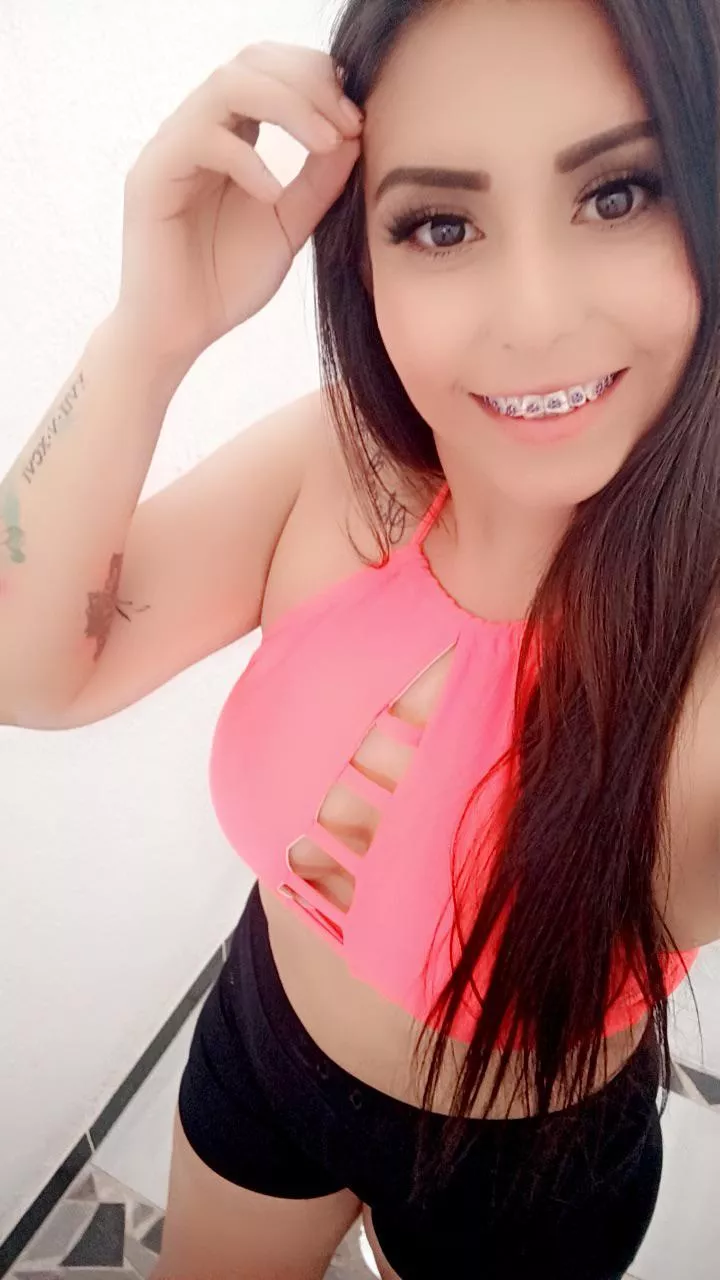 Do you like my braces?