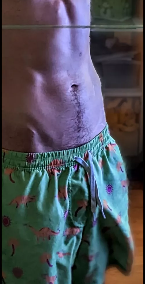 Do you want to see more?