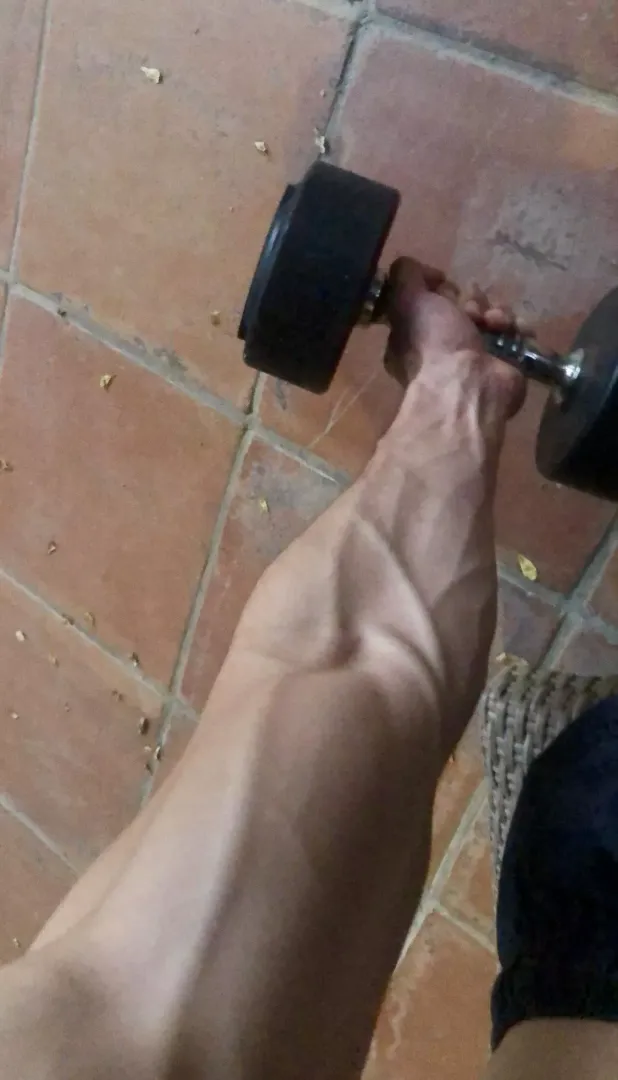 Doctors love my big veins, they can draw my blood super easily 😈😎😎
