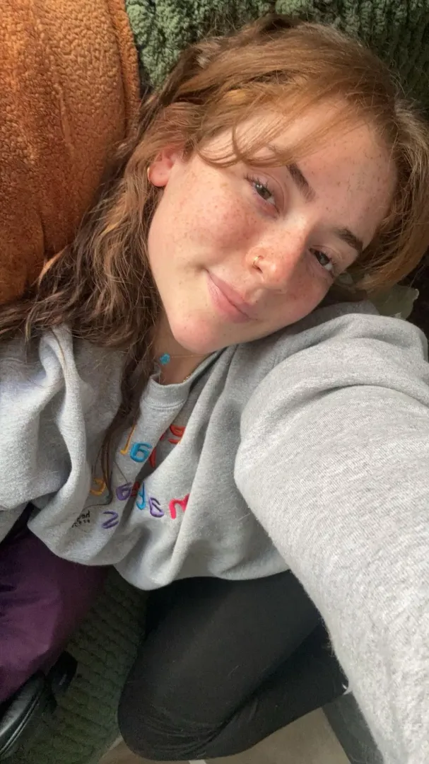Doesn’t get better than a red head with freckles? [IRTR]