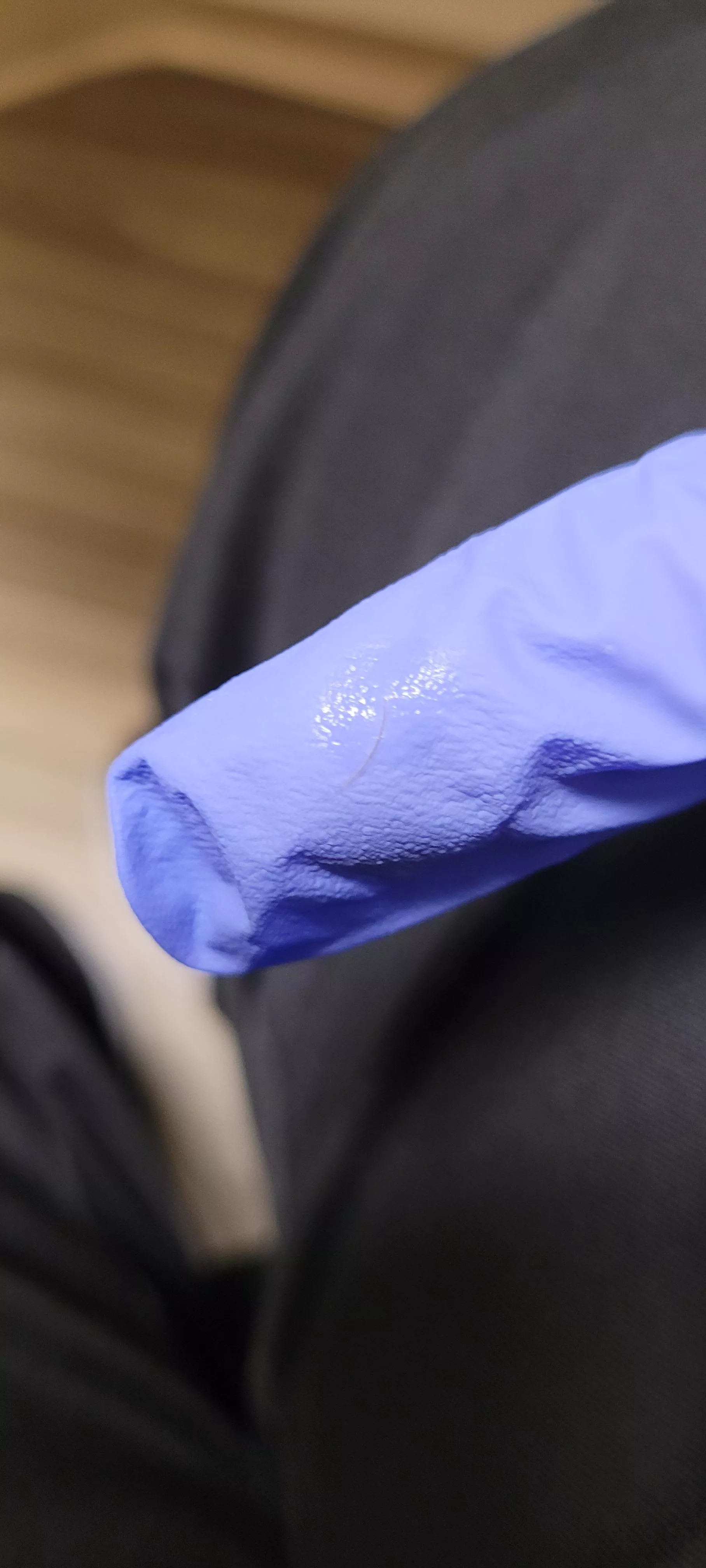 dog hair that got between my molar and my gums