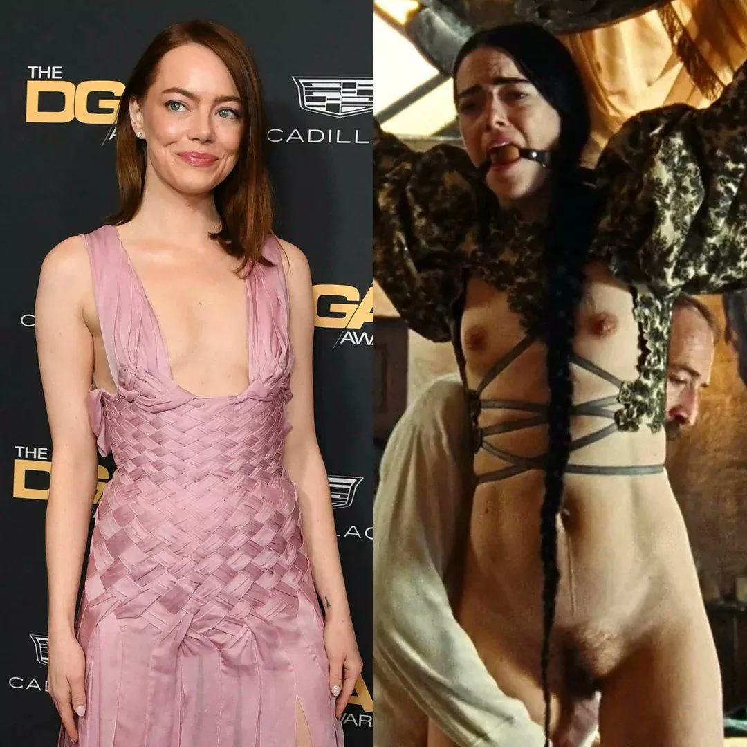 Emma Stone 
