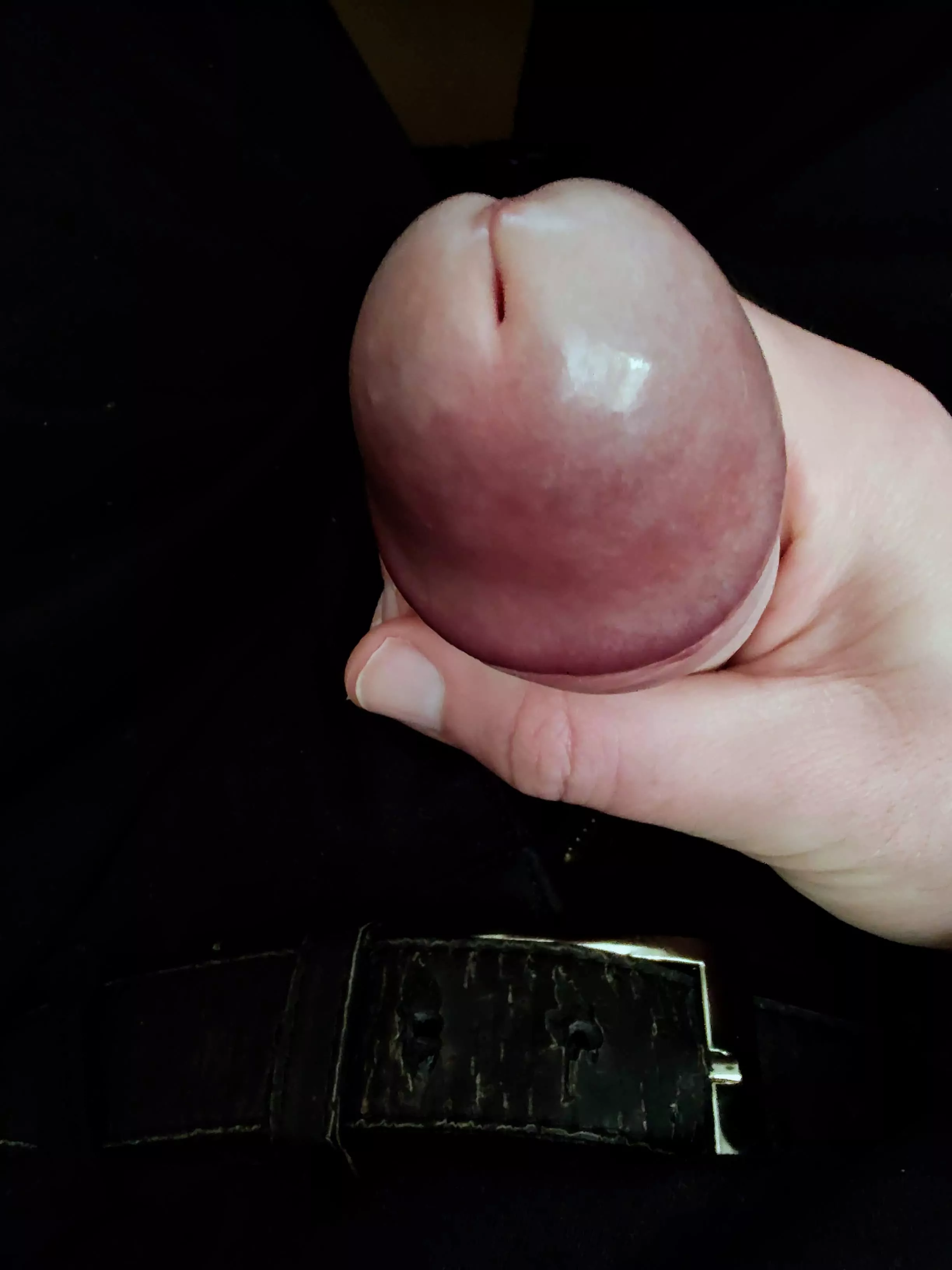 Extra sensitive head needs attention