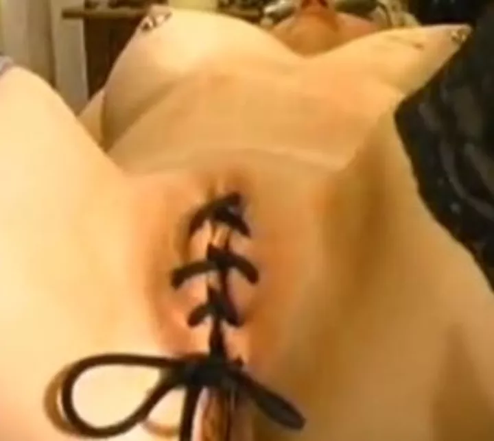 Extreme NNN