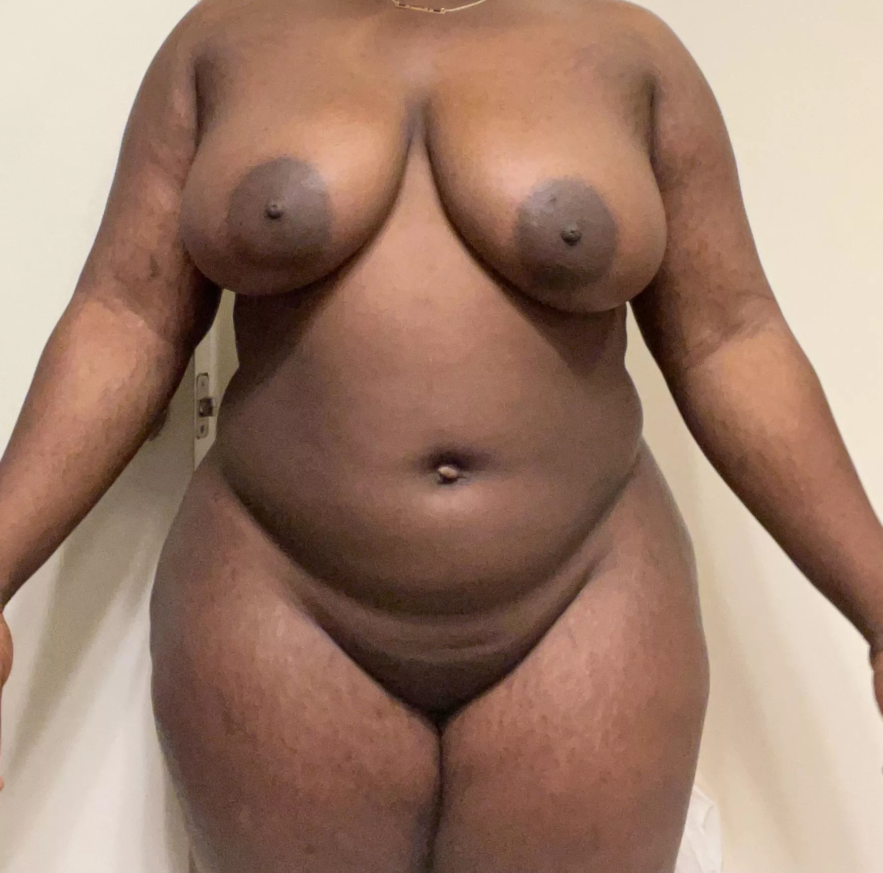 F22- 210lbs- 5’1- first time here but I have always been insecure about my big areola and stretch marks