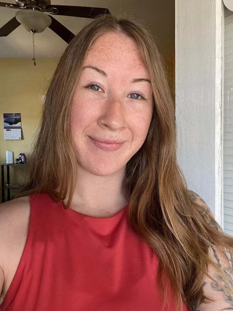 Face freckles