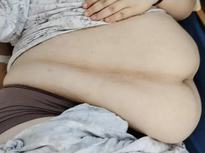 fat rolls