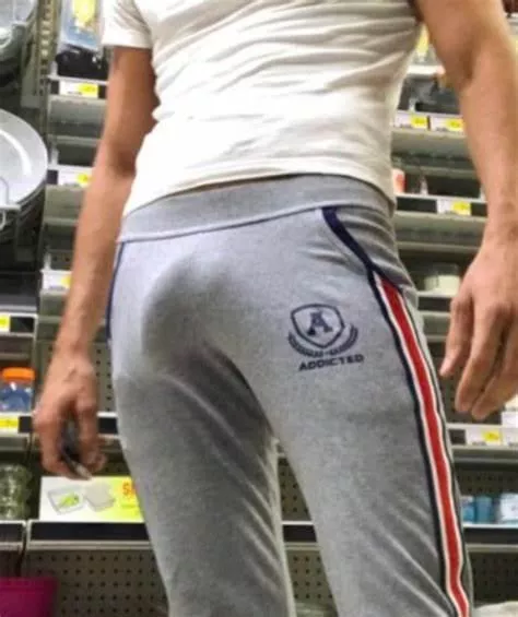 Few people gasped when they saw me at the supermarket. But what can i do?