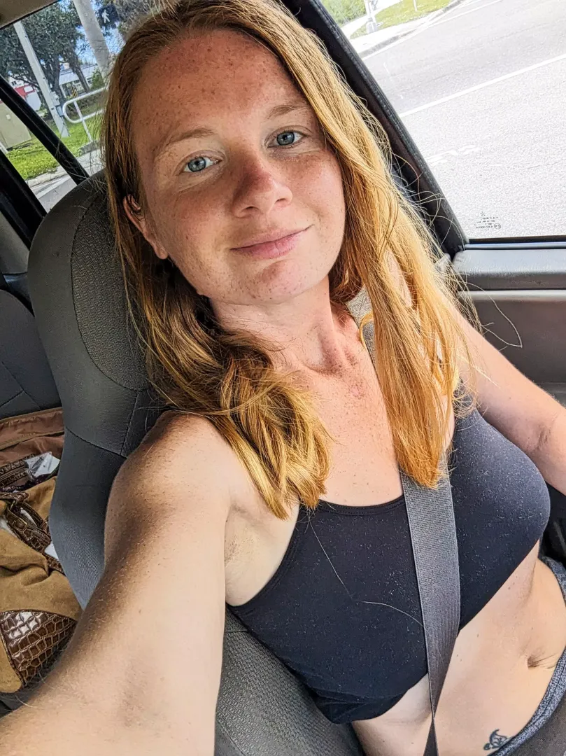 Fiery freckle fiesta, no filters🎊 [F27]