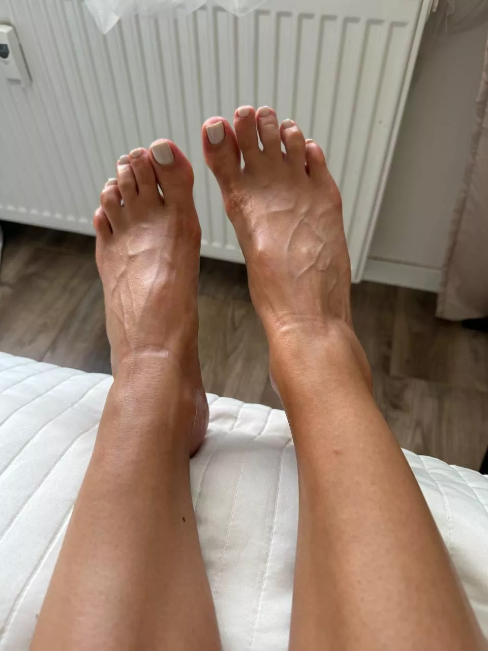 For veins lovers