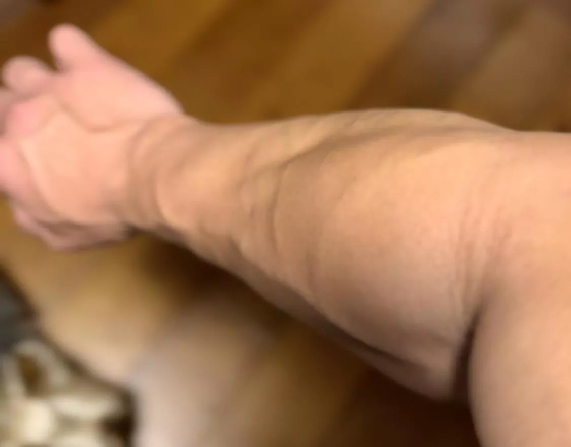 Forearm back shots
