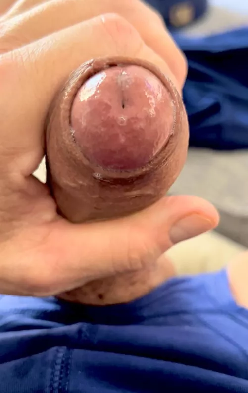 Foreskin/Precum play is fun 💦🍆