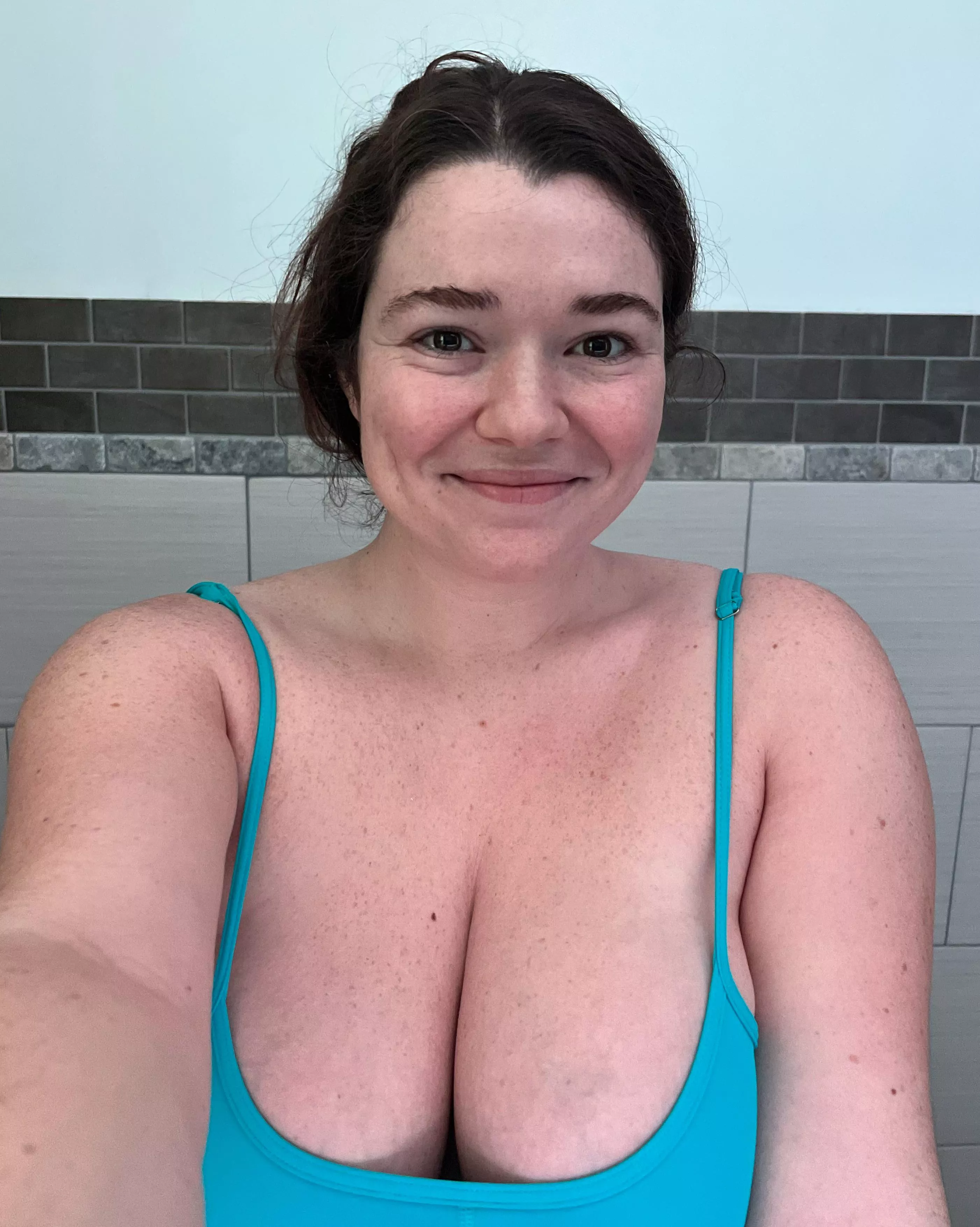 Freckle overload