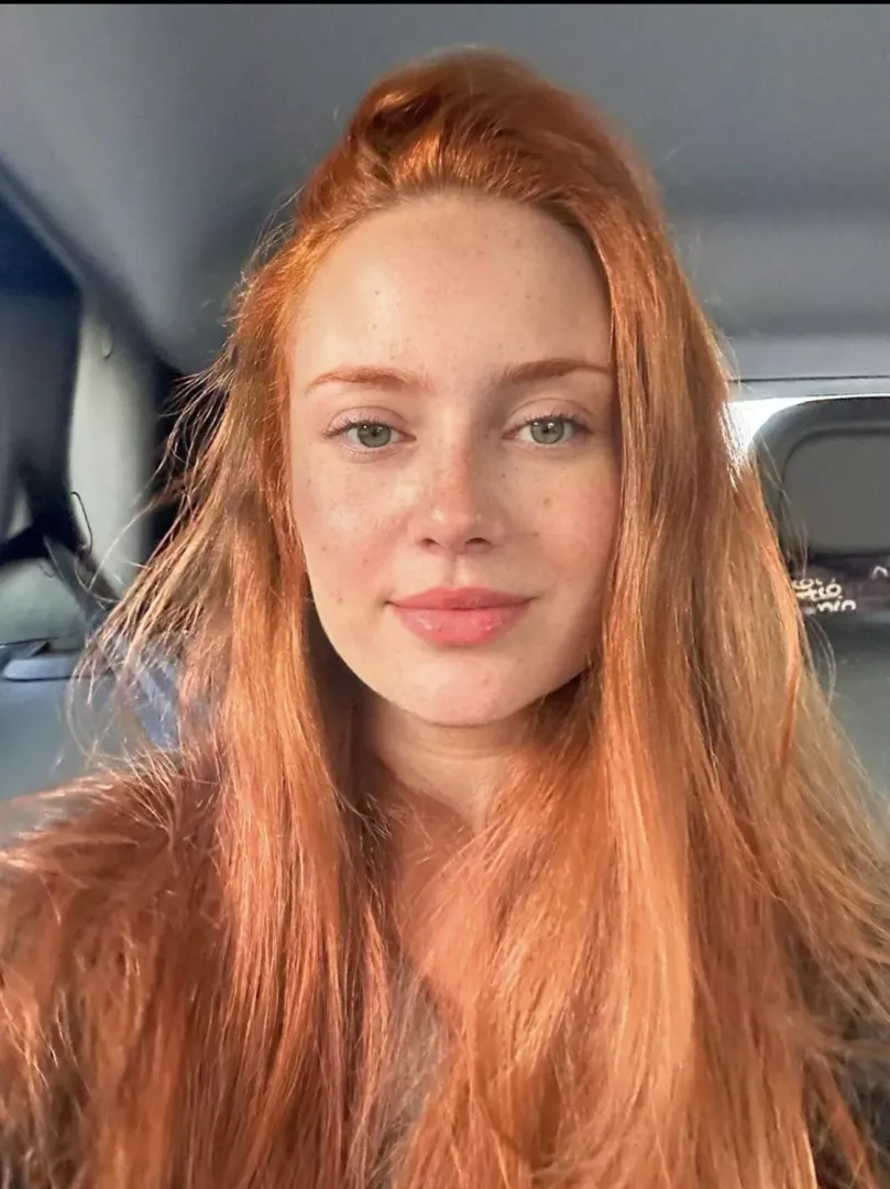 Freckles are all out today