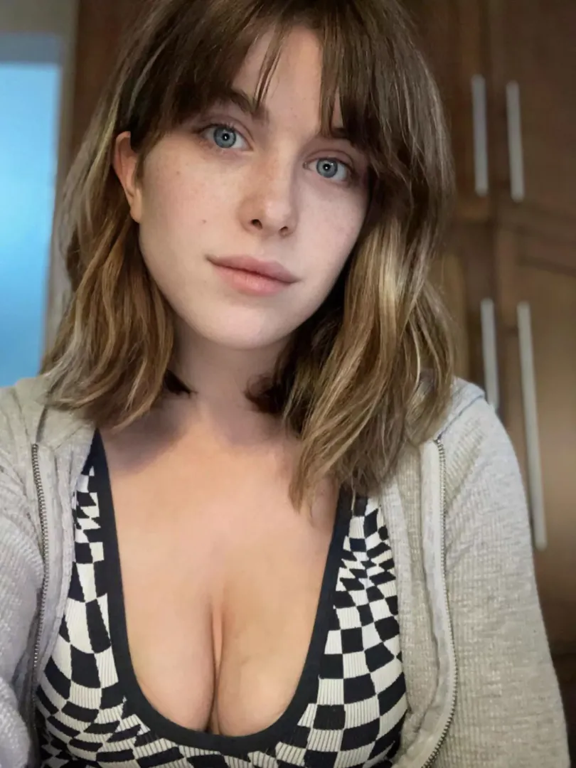 Freckles 