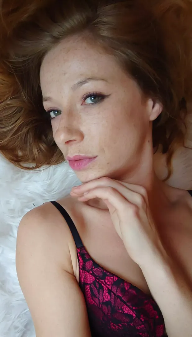 Freckles for days
