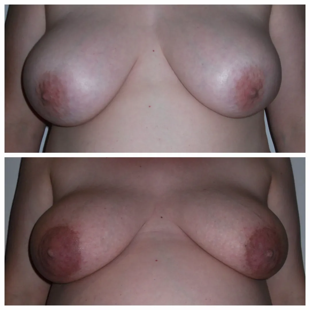 Friend pre-pregnancy to end of pregnancy. They definitely got engorged and veiny. Hope you enjoy.