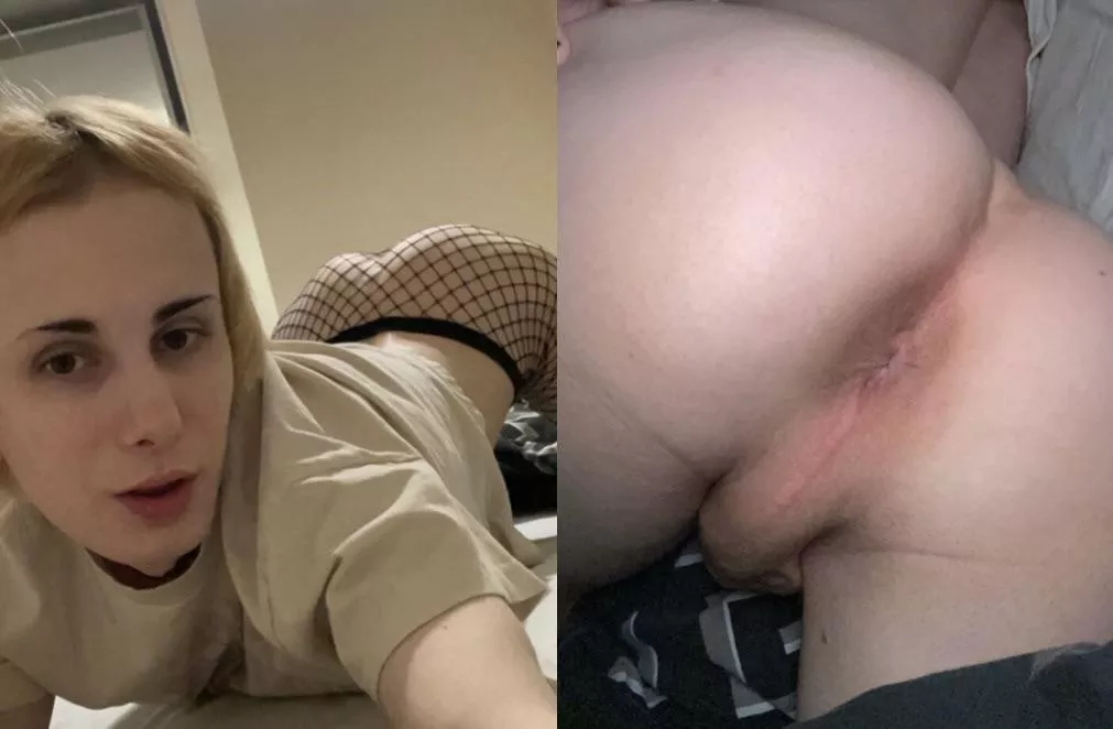 Front lips back lips 🤣🥰