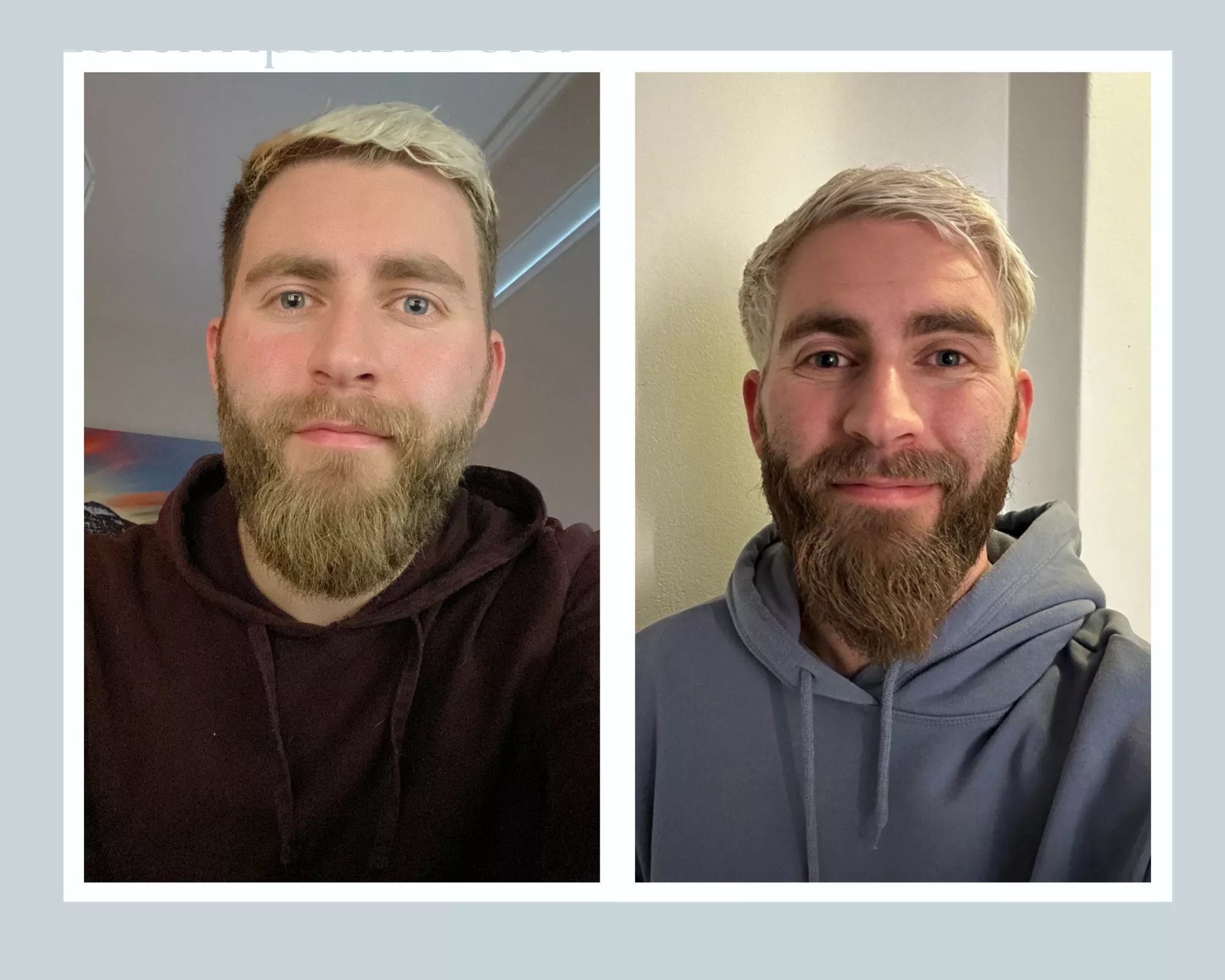 Got burnout a little over a year ago due to PTSD, depression and work stress. Just finished vocational rehab and started a promising and exciting new job last Wednesday! (Dec '21 vs Feb '23)