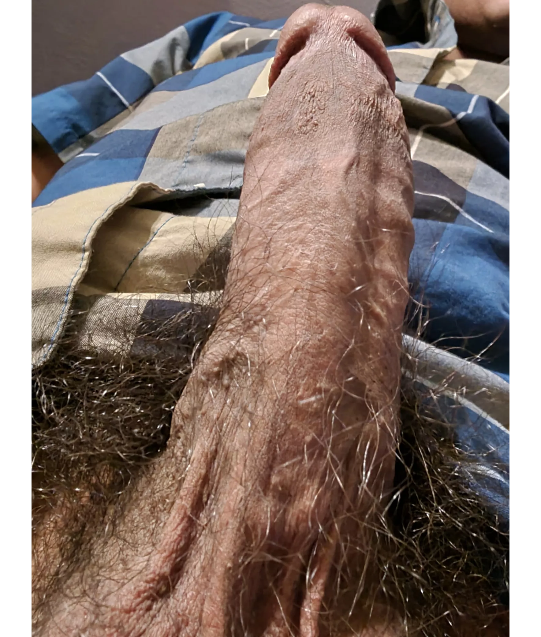 hairy cock in your face what do you do?