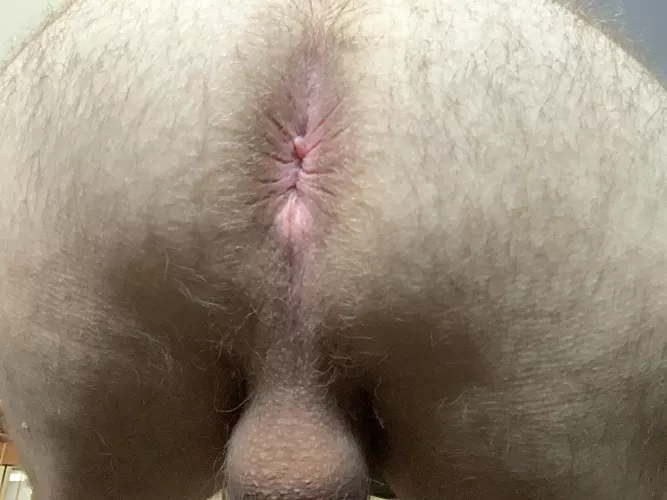 Hairy enough?