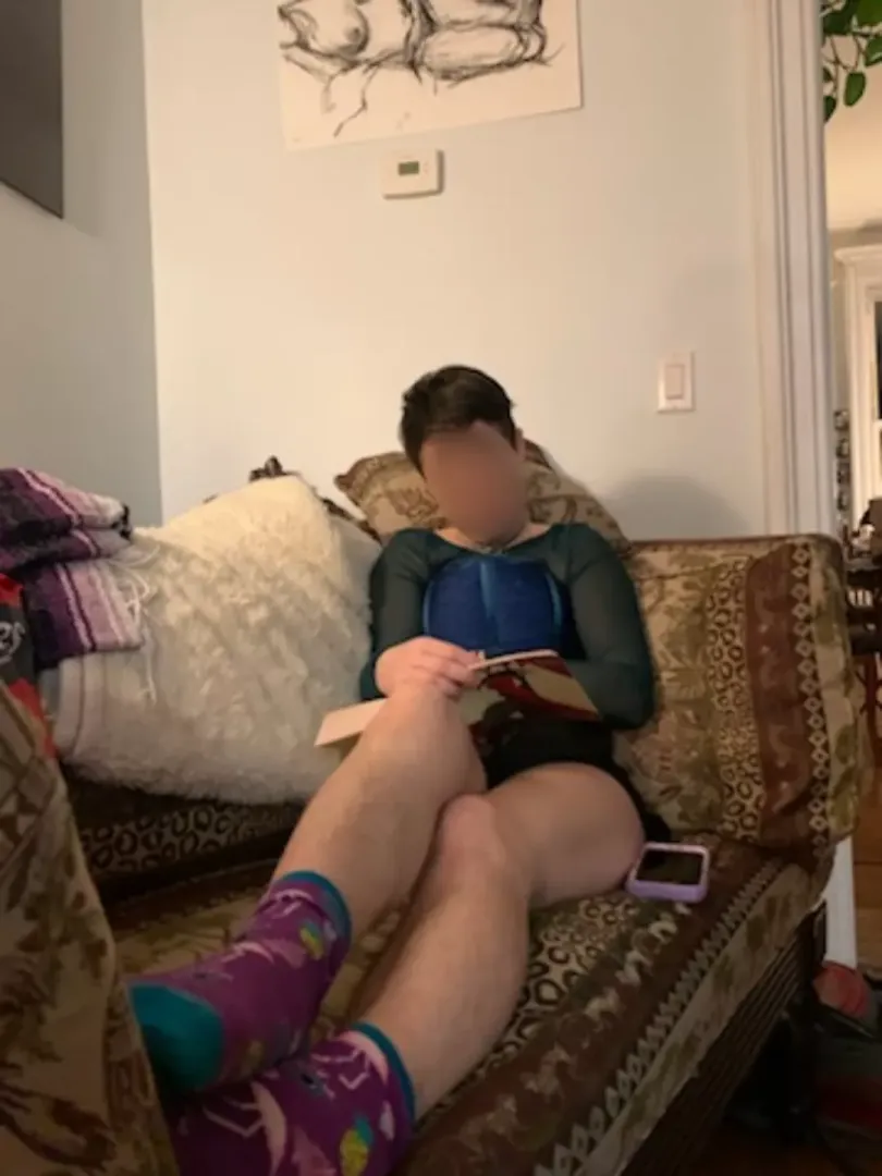 hairy legs
