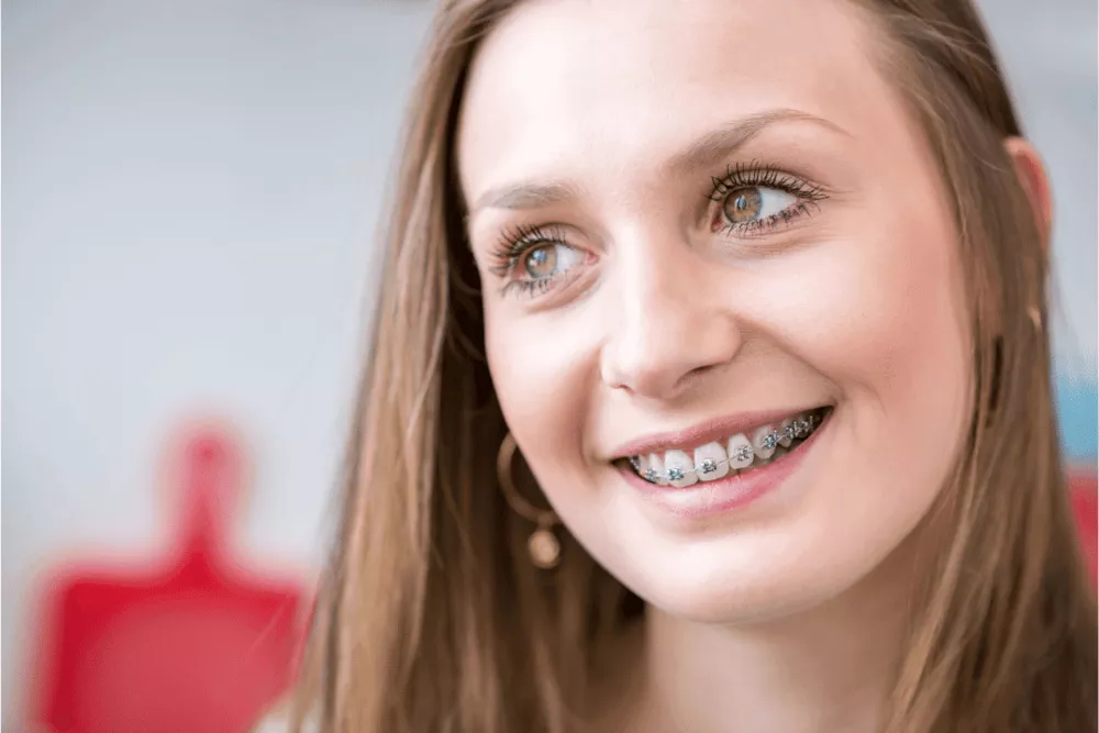 Hazel eyed milf mom in braces