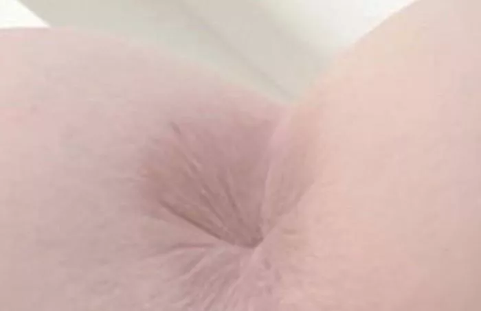 Help me gape!