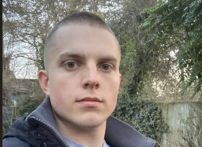 Hi guys! Really appreciate your perspective on that previous post! I once had my lips pierced like an idiot, but then had them removed, which has forever meant I am left with these ugly 'white' marks. I think they look weird AF. What that would be your