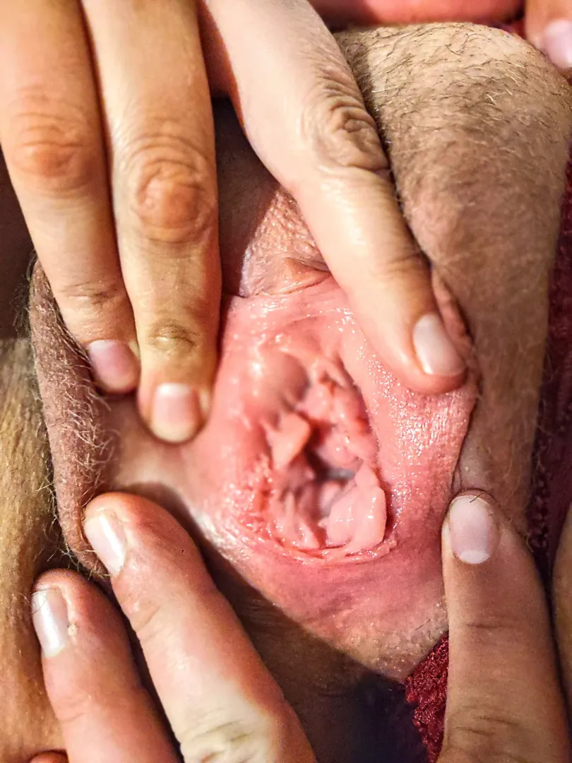 How's my gape?
