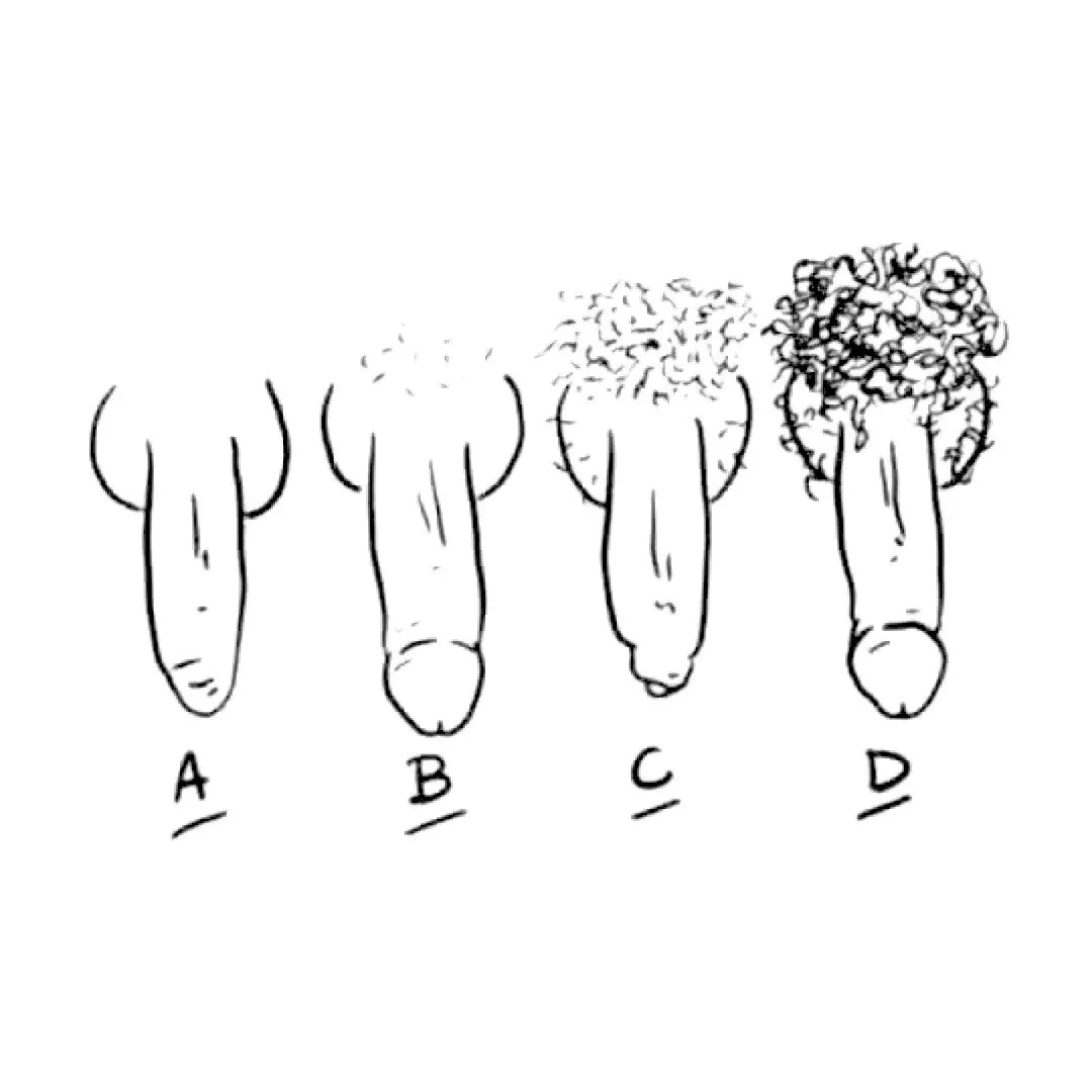 How's your bush today? 🤭🤭