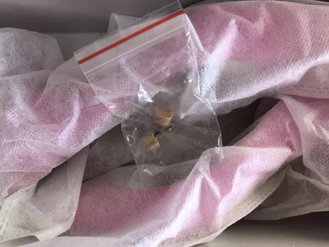 I bought these beautiful pink heels and I was wondering what these two things are in the middle?