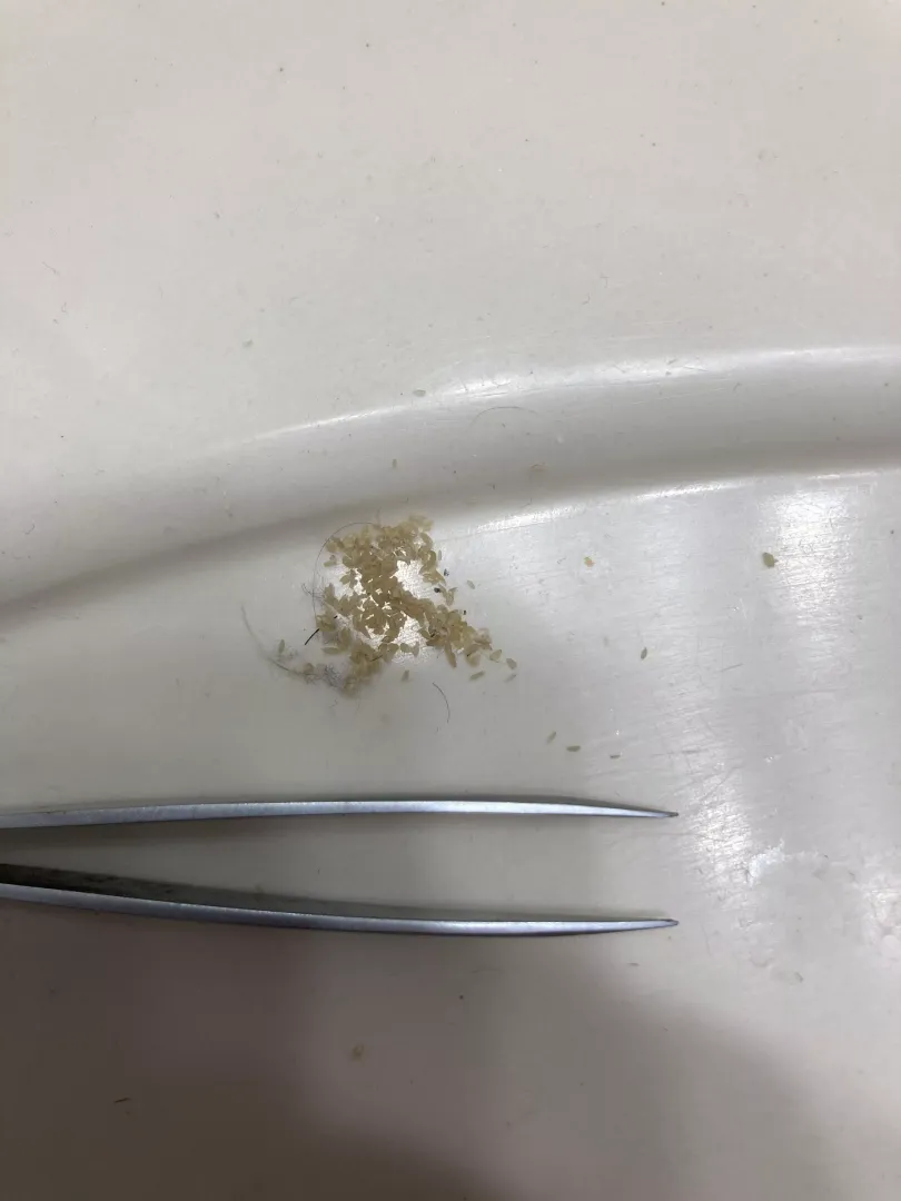 I don’t know what else to do with this picture. All of the blackheads I squeezed out of my nose in about 2 hours.