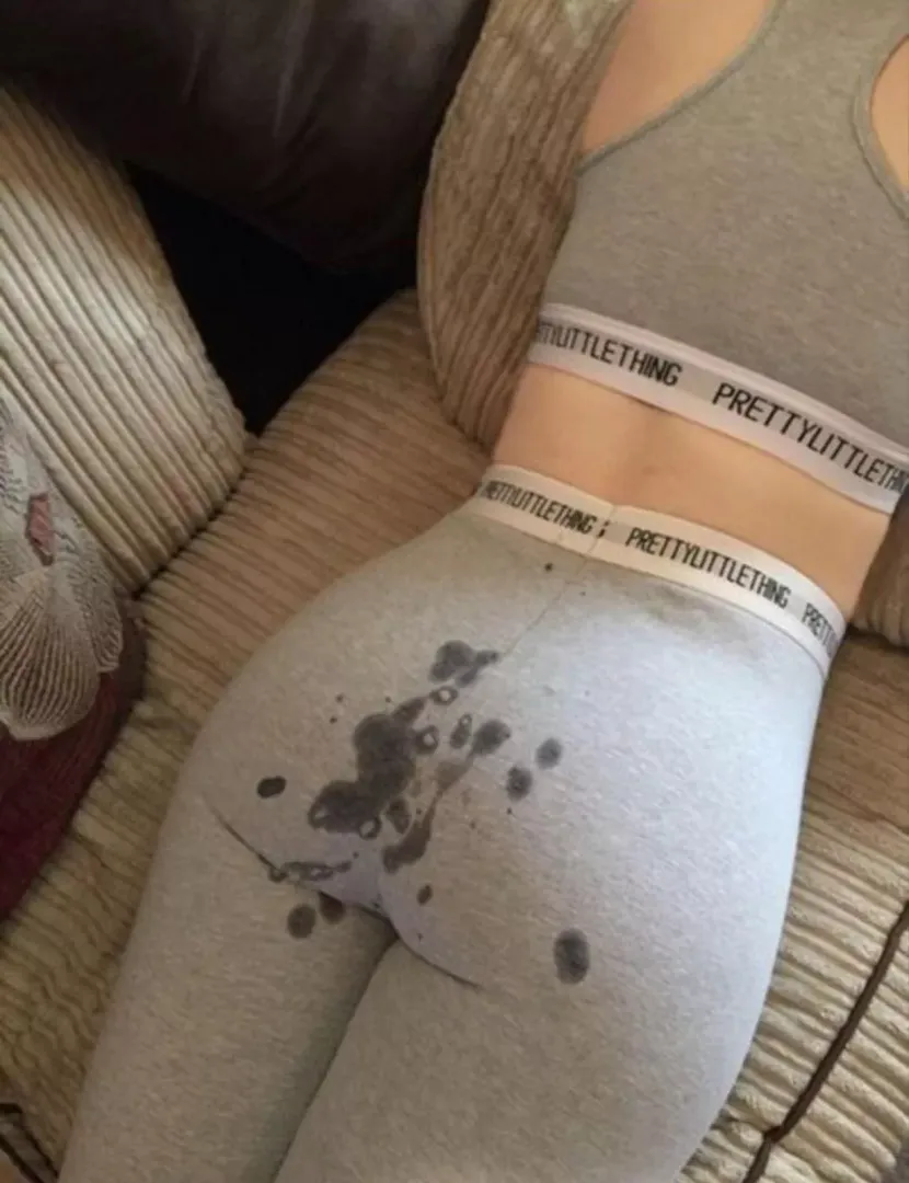 I guess it was my fault for wearing this...