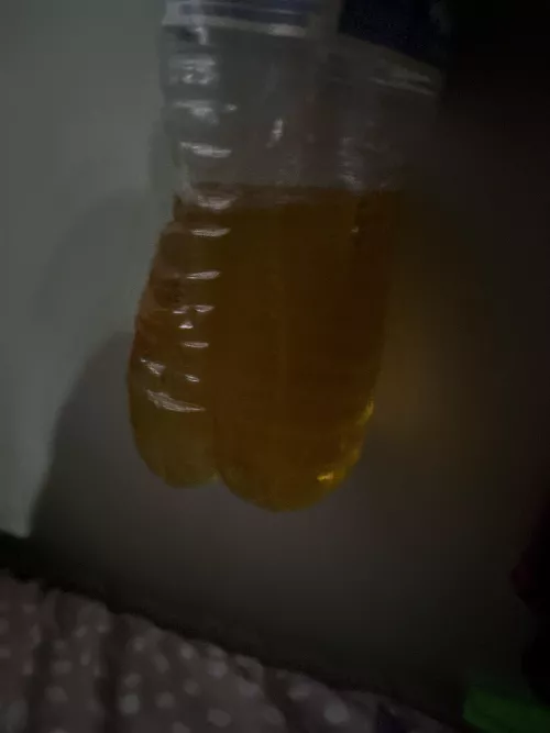 i just pissed in a bottle i had to go so urgently