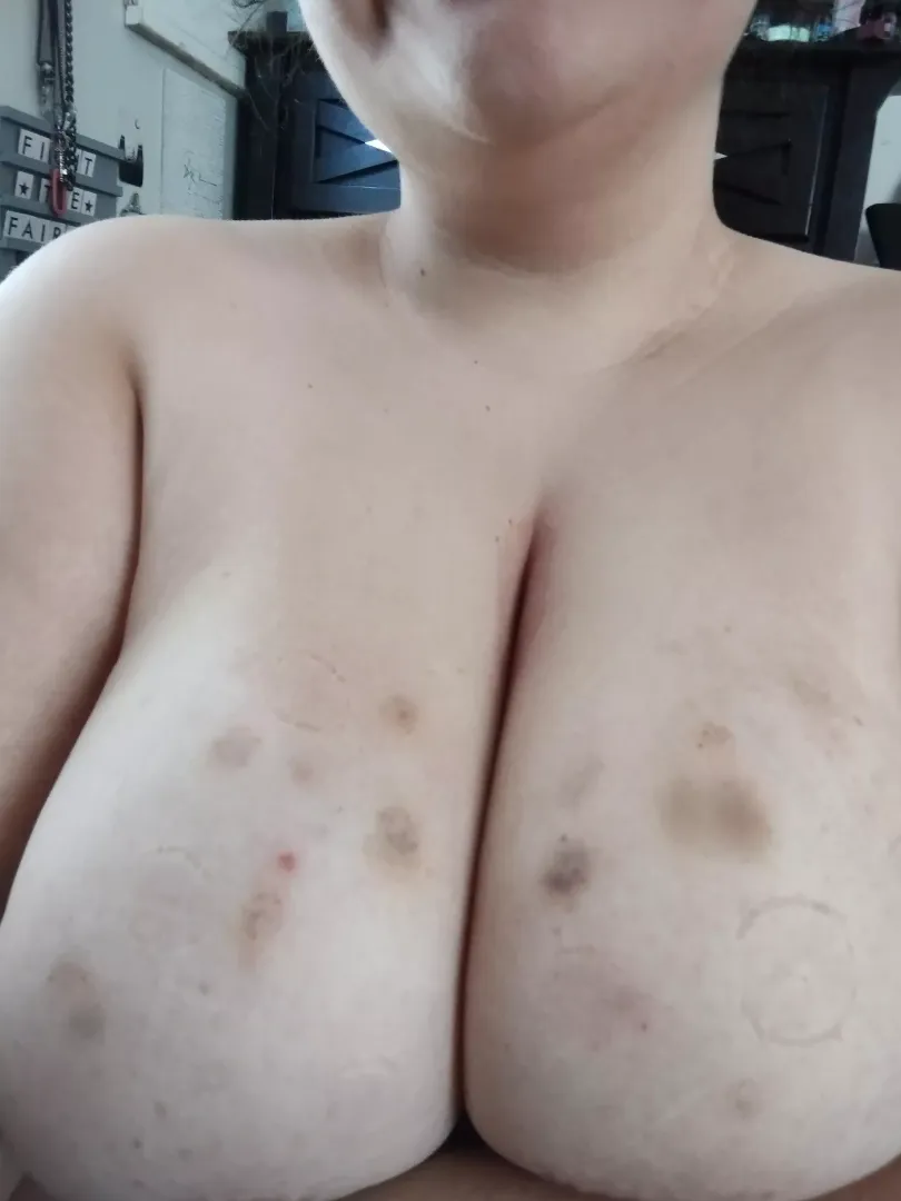 i love seeing the bruises and bites that my teeth can inflict 😍