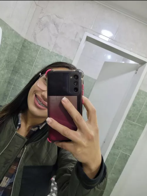 I miss my braces 