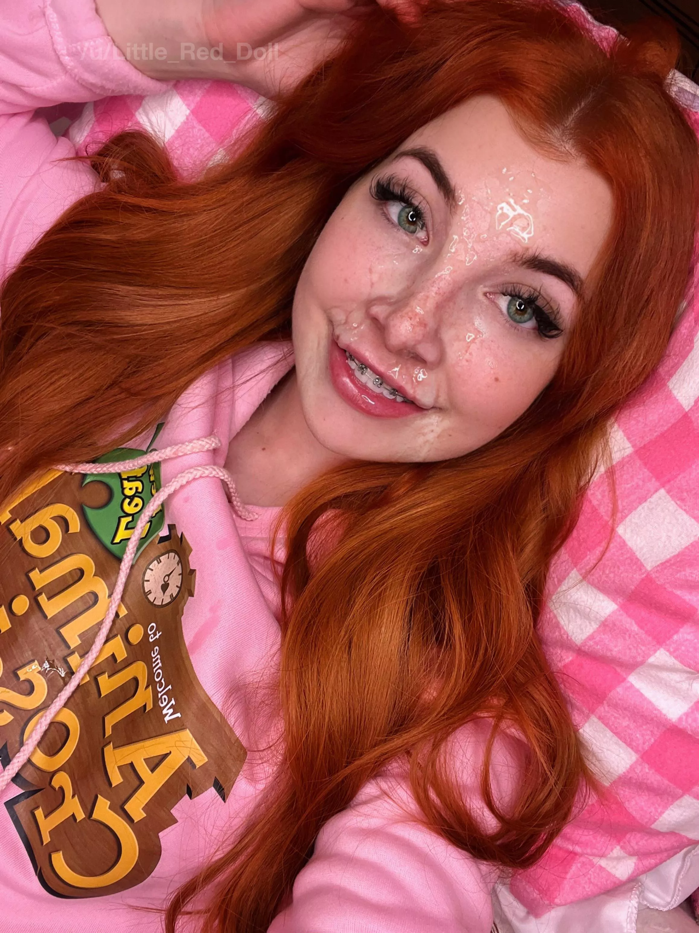 I need my braces covering can you help? 😋💦