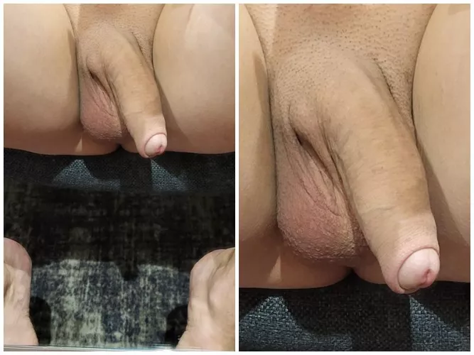 I prefer the zoom image