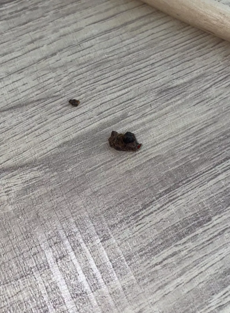 i pulled this chunk of earwax out of my ear today