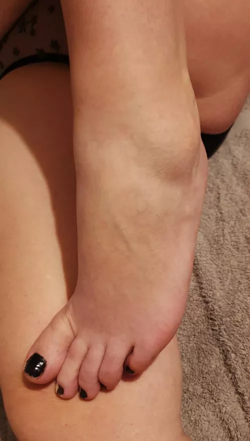 I think my feet could do with a little moisturising